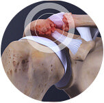 Electric Heating Shoulder Massager